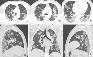 Imagem: Radiological Society of North America