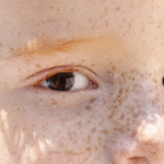 Reflexo branco nos olhos: entenda condição que assusta pais :teste deve ser feito entre 48 e 62 horas após o nascimento do bebê